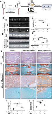 Scutellarin Protects Against Mitochondrial Reactive Oxygen Species-Dependent NLRP3 Inflammasome Activation to Attenuate Intervertebral Disc Degeneration